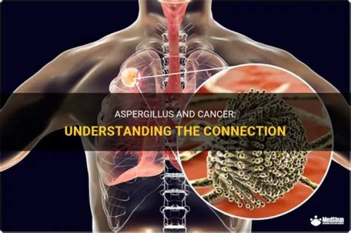 Can aspergillus cause cancer?