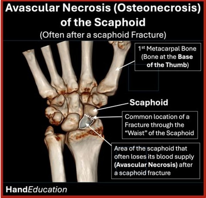 Is bone avascular or vascular?